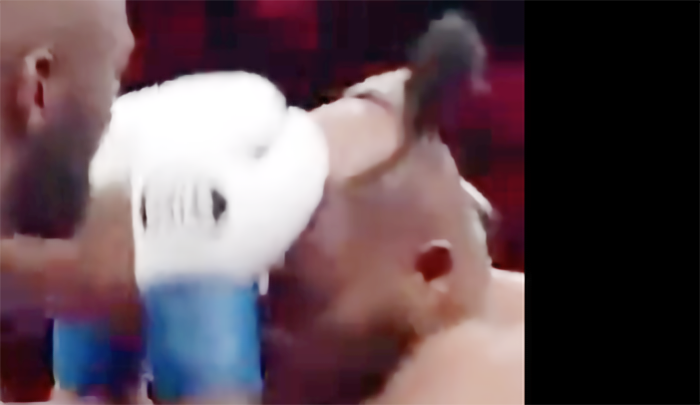 「やばい、恥ずかしい！」ボクシングでカツラが外れる珍事！「2日前にシャンプーと間違えて…」その悲惨な理由も