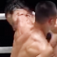 ヒジ攻撃で”額が陥没”映像が話題に！「この傷は一生残る」ファン恐怖＝ONE